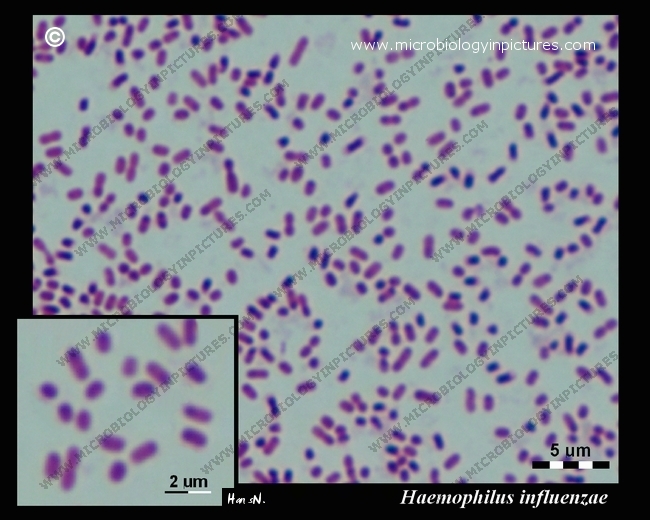 H.influenzae under microscope